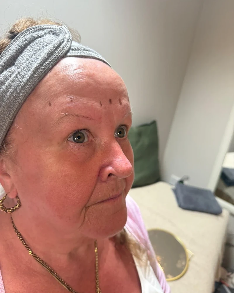 Before semi-permanent eyebrow tattoo treatment